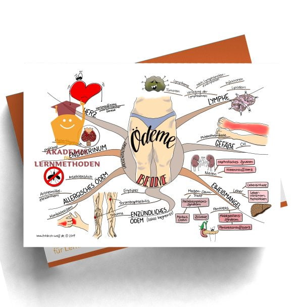 Mindmap zum Thema Ödeme Beine