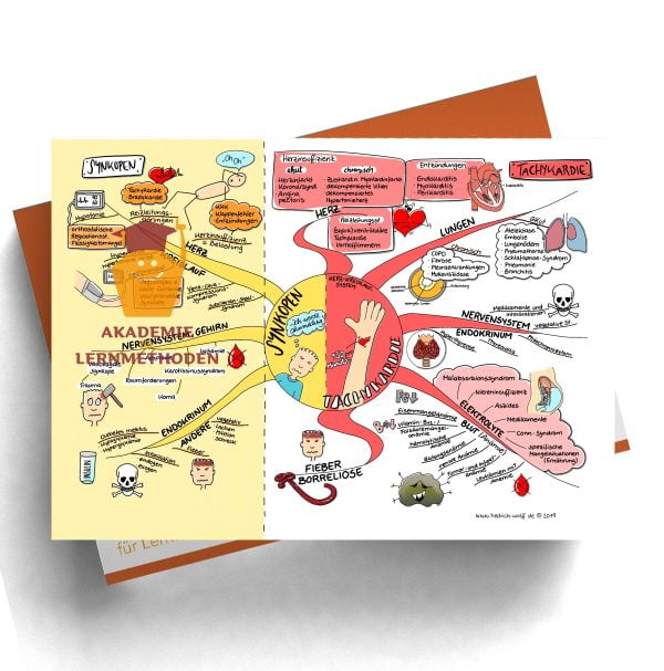 Mindmap zum Thema Synkopen - Tachykardie