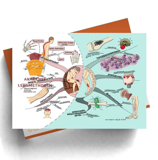 Mindmap zum Thema Gelenkschmerzen - Knochenschmerzen